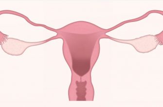 Rakovina děložního čípku