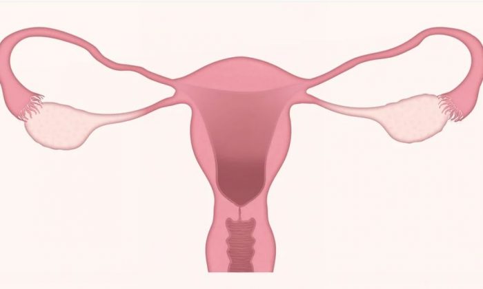 Rakovina děložního čípku