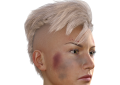 Modřiny