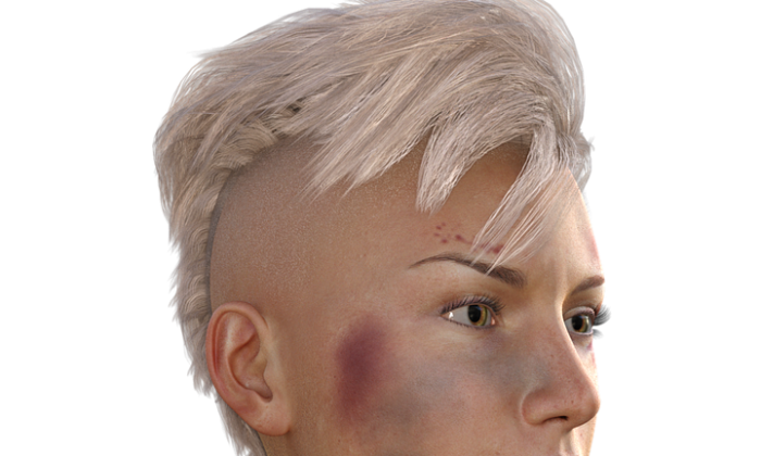Modřiny