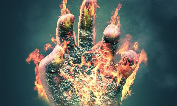 popáleniny ruky