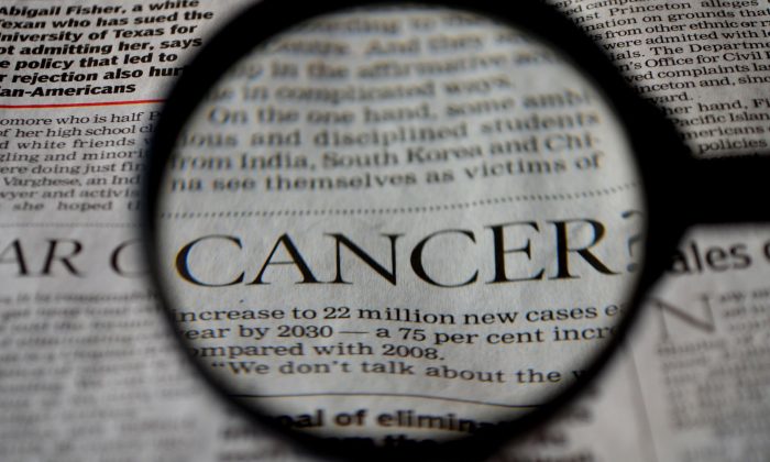 melanoma