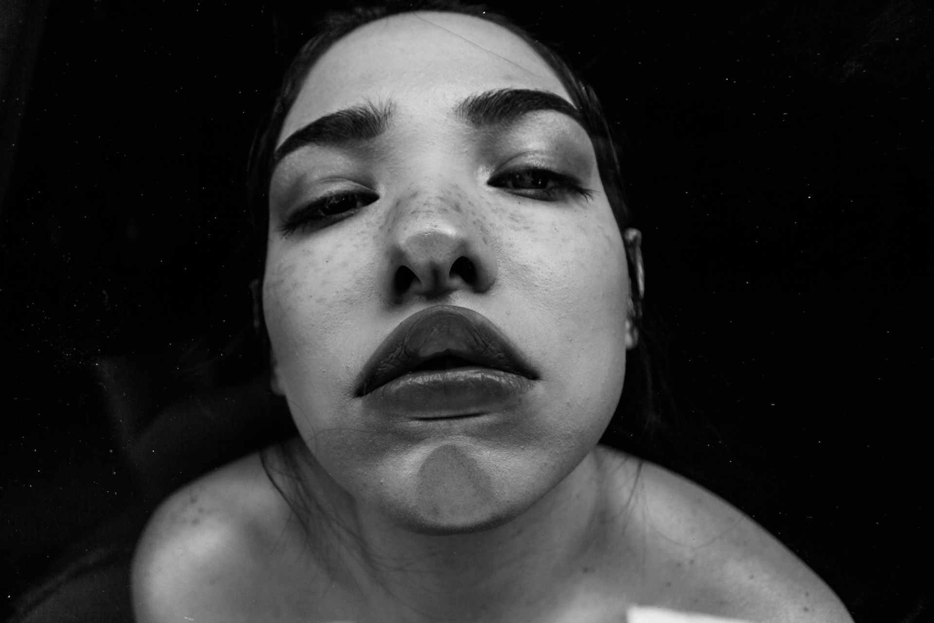 Botox